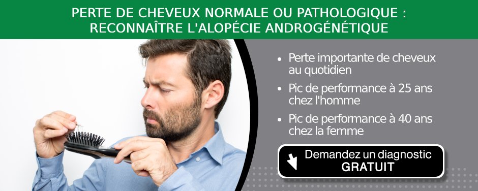 Homme qui perd des cheveux sans savoir si c'est naturel ou une alopécie androgénétique